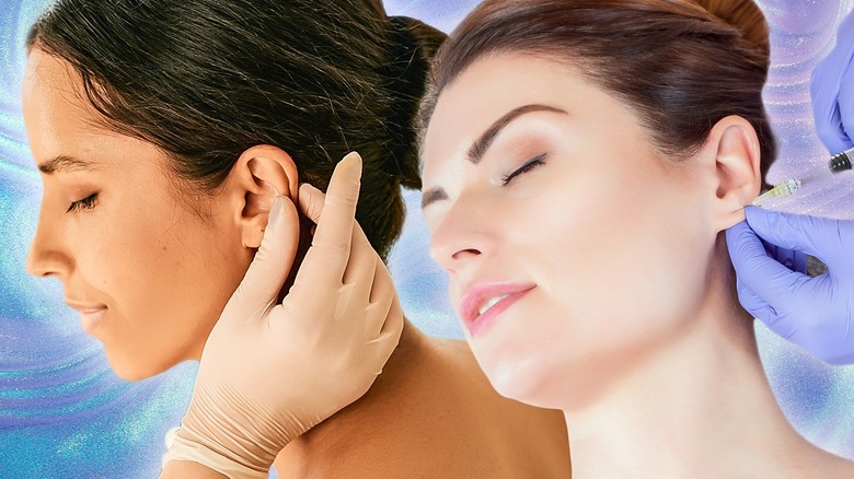 Women with ear piercing keloids 